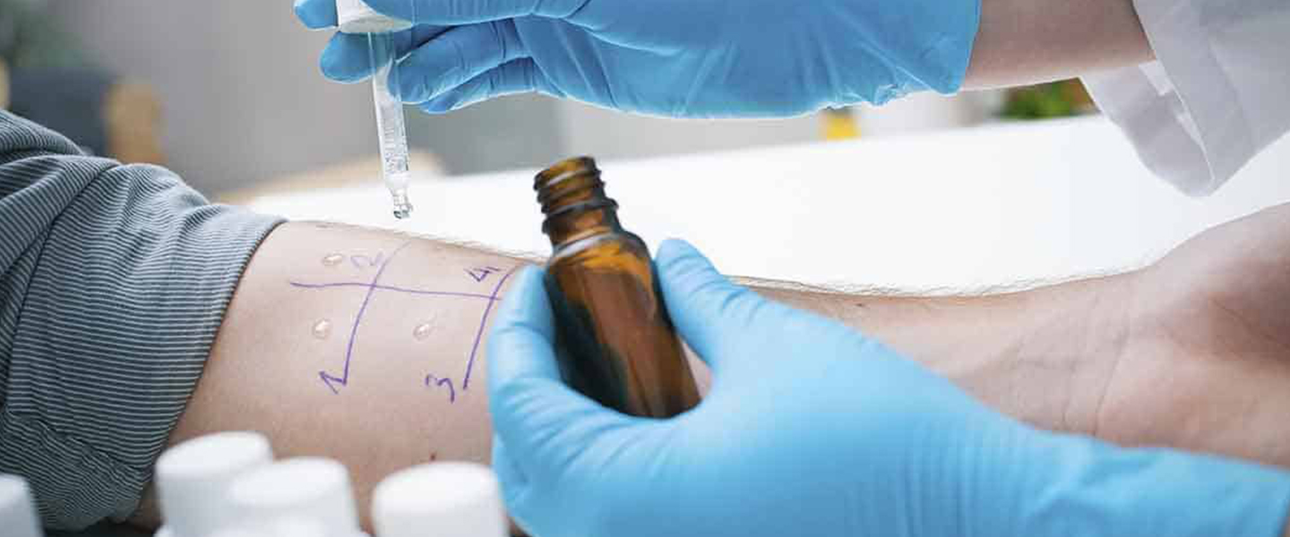 Allergy Test