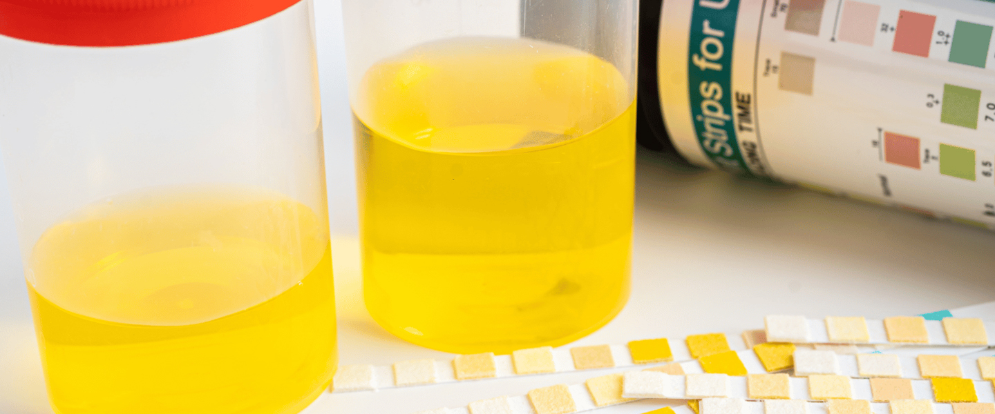 Urine Test